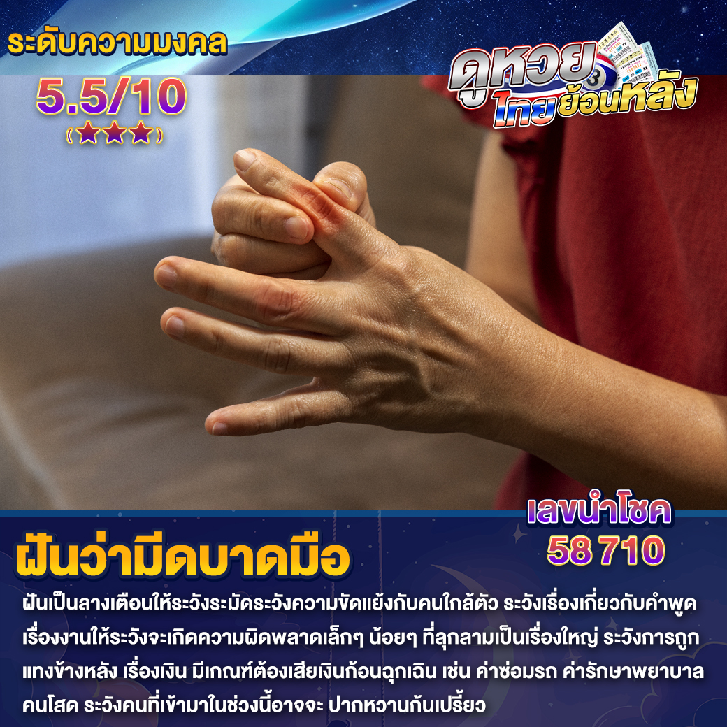 ฝันว่ามีดบาดมือ
